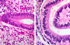 Proliferative (many mitotic nuclei) vs. secretory (basal glycogen vacuoles)