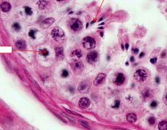 Spermatazoa