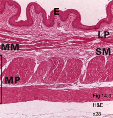 E: epithelium
LP: lamina propria
SM: Submucosa
MM: muscularis
mucosae