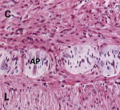 Two Layers of Muscularis Propria
C: circular muscle layer
L: longitudinal muscle
layer
AP: Auerbach’s plexus