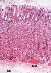 Gastric Mucosa
F: Gastric pits
C: Chief (peptic) cells
MM: muscularis mucosa
SM: submucosa