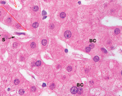 Hepatocytes with sinusoids and binucleated cells