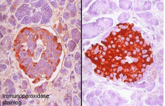 Endocrine pancreas: islets of Langerhans

Antibody to insulin identify the β
cells. Insulin induces increased
glycogen synthesis in liver (and
muscle)

Antibody to glucagon identifies the
α cells. Glucagon causes the liver
to release glucose - st