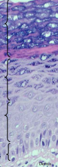 Layers of epidermis. Stratum corneum, stratum luciderm, stratum granulosum, stratum spinosum, stratum basale