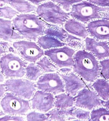 Stratum spinosum with arrows showing desmosomes. Keratinization begins here