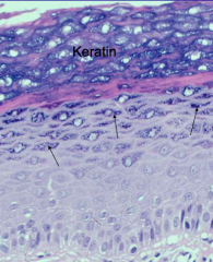 Keratohyaline granules. Filaggrin and keratin crosslink and form waterproofing of skin