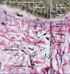 Epidermis, papillary dermis, reticular dermis