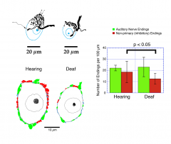 DEC. in deafness
- excitatory terminals remain relatively similar
- HOWEVER the inhibitory inputs are released and so we think thats why tinnutus starts up