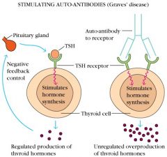 Target Ag: TSH-R
Mech: Stimulating Ab to TSH-R
- cross reactive Tc with Ag in extraocular muscles
Clinical Effect: Hyperthyroidism
- goitre
- opthalmopathy