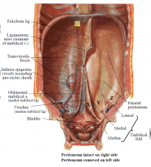1. Falciform ligament, with ligamentum teres in its lower edge, ends at umbilicus.
2. Median, medial & lateral umbilical folds are ridges formed respectively by peritoneum over the urachus (abdominal remnant of allantois), L&R obliterated umbilic...