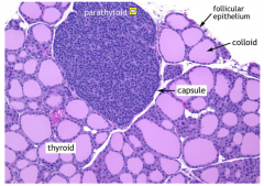 parathyroid gland is essential for life needs ot be conserved in thyroid cells