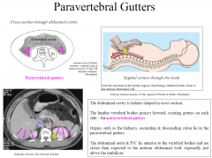 The abdominal cavity is kidney-shaped in cross section
The lumbar vertebral bodies project forward, creating gutters on each
side – the paravertebral gutters
Organs such as the kidneys, ascending & descending colon lie in the
paravertebral g...