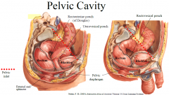 -
Peritoneum extends into pelvic cavity and reflects on pelvic viscera to form dependent pouches
-
Pouches in female: uterovesical and rectouterine (Pouch of Douglas)
-
Pouch in male: rectovesical
-
When supine or erect, infectious material...