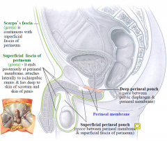 Urogenital triangle divided into superficial and deep perineal pouches for descriptive purposes. Boundaries are: pelvic diaphragm  to perineal membrane  superficial fascia of perineum