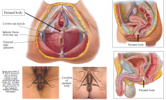 -
Comprised of connective tissue (collagen, elastin), smooth muscle and skeletal muscle - At center point of perineum between urogenital and anal triangles - Critical stabilising structure in the perineum - Receives insertion of levator ani, exte...