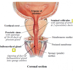 -Secretions contribute to seminal fluid, 20-30 ducts drain into prostatic sinus of prostatic urethra
-Firm, dense, fibromuscular gland, ~4cm long
-Palpation (digital rectal exam): firm to palpation, triangular-shape posteriorly with median groov...