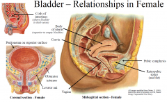 Anterior - retropubic space and pubic bone/pubic symphysis
Superior - coils of intestines and body of uterus
Inferolateral - levator ani & obturator internus
Posterior - cervix of uterus and vagina (not rectum)
