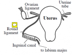 Round ligament & ovarian ligament are the remains of the gubernaculum in the female
They attach to the uterus below the uterine tube.
Round ligament passes through inguinal canal to labium majus