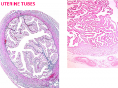Mucosa
longitudinal folds project into the lumen
lined with ciliated & non-ciliated columnar epithelial cells
Muscularis
inner circular, outer longitudinal smooth muscle layers
Serosa (peritoneum)
Mesothelium & thin connective tissue layer
