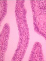 - lined with cilia allowing for motility