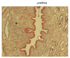 The urethral epithelium is stratified
- initially, next tobladder, is transitional epithelium (dome shaped cells on top of columnar cells)
- then becomes more of a stratified squamous epithelium next to the skin