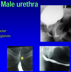 
prostatic part

membranous

external sphincter

bulbourethral glands

bulbar urethra

penile urethra