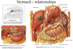 Anterior: liver, diaphragm, anterior abdominal wall
Posterior (“stomach bed”): through the lesser sac it is related to: diaphragm, left suprarenal gland, left kidney, pancreas, splenic artery, transverse colon & transverse mesocolon; and thro...