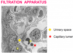 1. glomerular capillaries
fenestrated (90nm diameter) - i.e nothing larger than 70KDa
diaphragm is absent

2. glomerular basement membrane
350nm (the podcytes add thickness)
double as thick than normal

3. Visceral layer of Bowman’s Caps...