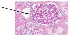 Located in wall of distal convoluted tubule
Tall, narrow cells, nuclei appear crowded
Low [Na+] in distal tubule
Macula densa release prostaglandins
Paracrine affect on juxtaglomerular cells