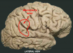 L: lies at the posterior extent of the lateral sulcus in the parietal and superior temporal regions. 
A: It is critical for language comprehension and damage to it results in "fluent aphasia" - the patient is unable to understand the content words while 