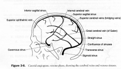 - confluence of the sinuses
- transverse sinus
- straight sinus
