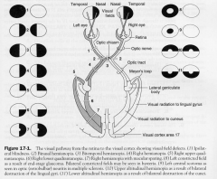 1. ganglion cells of retina
2. optic nerve
3. Optic chiasm
4. Optic tract
5. LGN
6. Geniculocalcarine tract (visual radiation)
7. Visual cortex