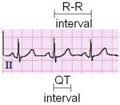 400-440 ms
(0.4 to 0.44 seconds). 

longer 

 Also, lower heart rates result in a _______ QT interval.