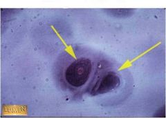Q1 These cells fill what spaces?

Q2 What kind of cartilage is this?
