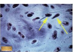 Q1 What kind of cartilage is this?

Q2 The indicated cells fill what spaces?