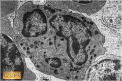 Q1 What is the name of this cell?

Q2 What are the dark staining vesicles in its cytoplasm called?