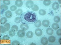 What does this cell differentiate into once it leaves the blood?