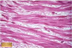 Q1 Name the tissue.
Q2 Name the loose
irregular connective tissue that lies between these cells.