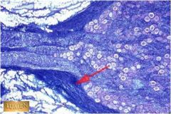 Q1 What is the name of this connective tissue covering? (Dark Blue)
Q2 What is it composed of primarily?