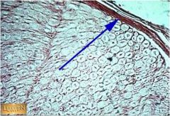 Q1 What is this tissue? 
Q2 Name the layer of connective tissue that the arrow is indicating.