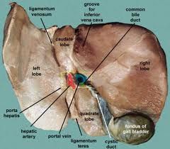 (LP) Fissure for
Ligamentum Venosum

(LA) Fissure for 
Round Ligament of Liver

(RP  )Inferior Vena Cava

(RA ) Gall Bladder

(Middle) Porta Hepatis