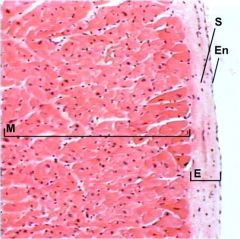 -a simple squamous 
-endothelium 
subendothelial  loose connective tissue 
-Thick layer of dense connective tissue
-a simple squamous -endothelium 
-subendothelial  loose connective tissue 
-subendocardial layer