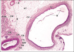 HEART. KEY:
A, atrium
; AT
adipose tissue
AVN
atrioventricular node
CM
cardiac
muscle; 
CT
connective tissue
DCT
dense connective tissue
En
endothelium
ID
intercalated disk
IEM
MV
mitral valve
PF
Purkinje fibers
SM
smooth muscle
V,
