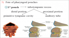 Tubotympanic Recess =

-Tympanic cavity distal

-Auditory Tube Proximal