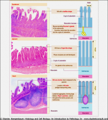 Histologic differences between the
duodenum  
jejunum  
ileum  
picture
info