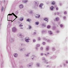 Identify a cell type
A) spermatid
B) primary spermatocyte
C) spermatogonium
D) Leydig cell
