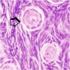 Identify a histological feature
A) seminiferous tubule
B) primordial follicle
C) lactiferous duct
D) zona pelucida