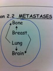 Breast --- to bone and brain
Lung--- to brain and bone
Bone---to breast and lung
Brain---to lung and breast