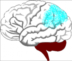 -cannot perform an act on command or request 
-cannot understand a command or request
-cannot select the correct tool for the requested task
-cannot perform the act when given the correct tool

Lesions are typically in the left parietal lobe