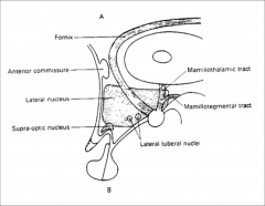 the lateral hypothalamic area